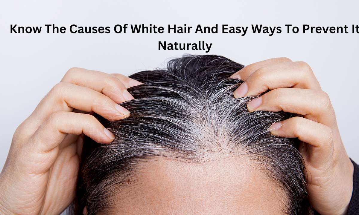 Know The Causes Of White Hair And Easy Ways To Prevent It Naturally
